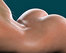 3D Image Set 45